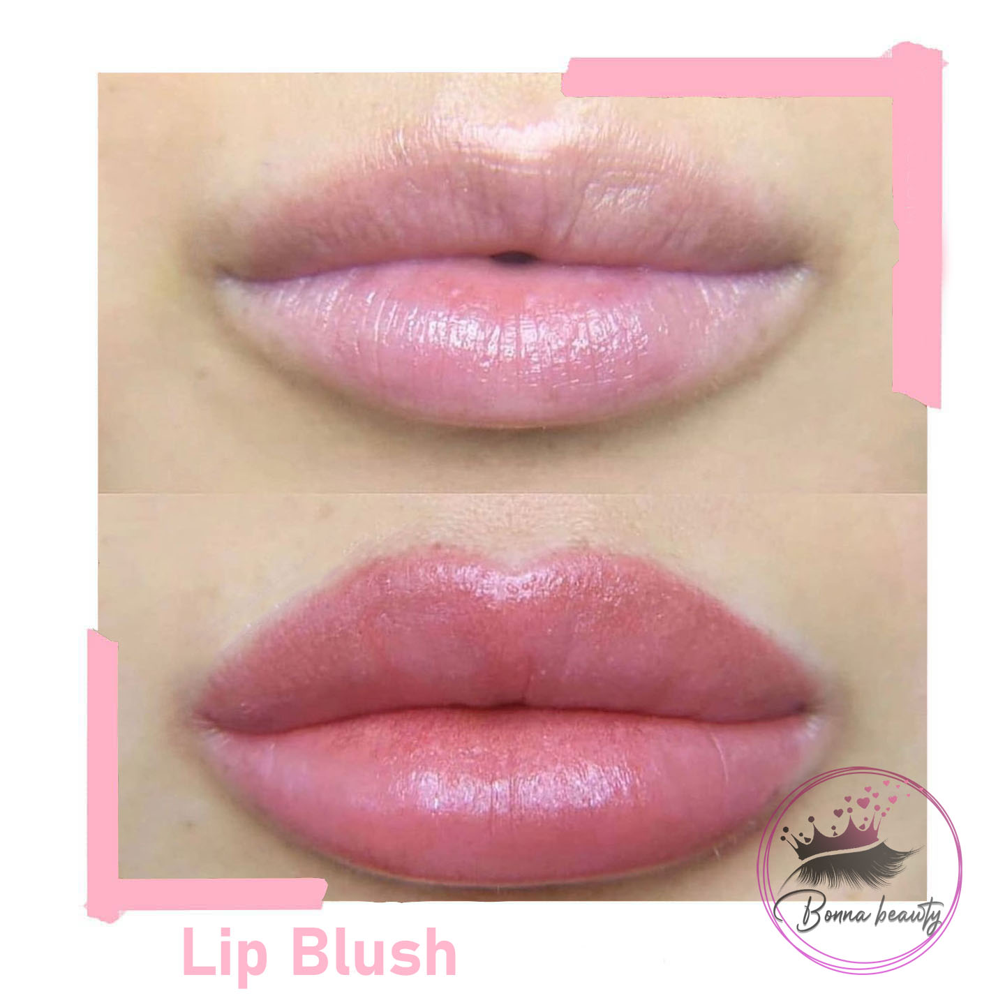How to prepare for Lip Blush Tattooing before procedure?