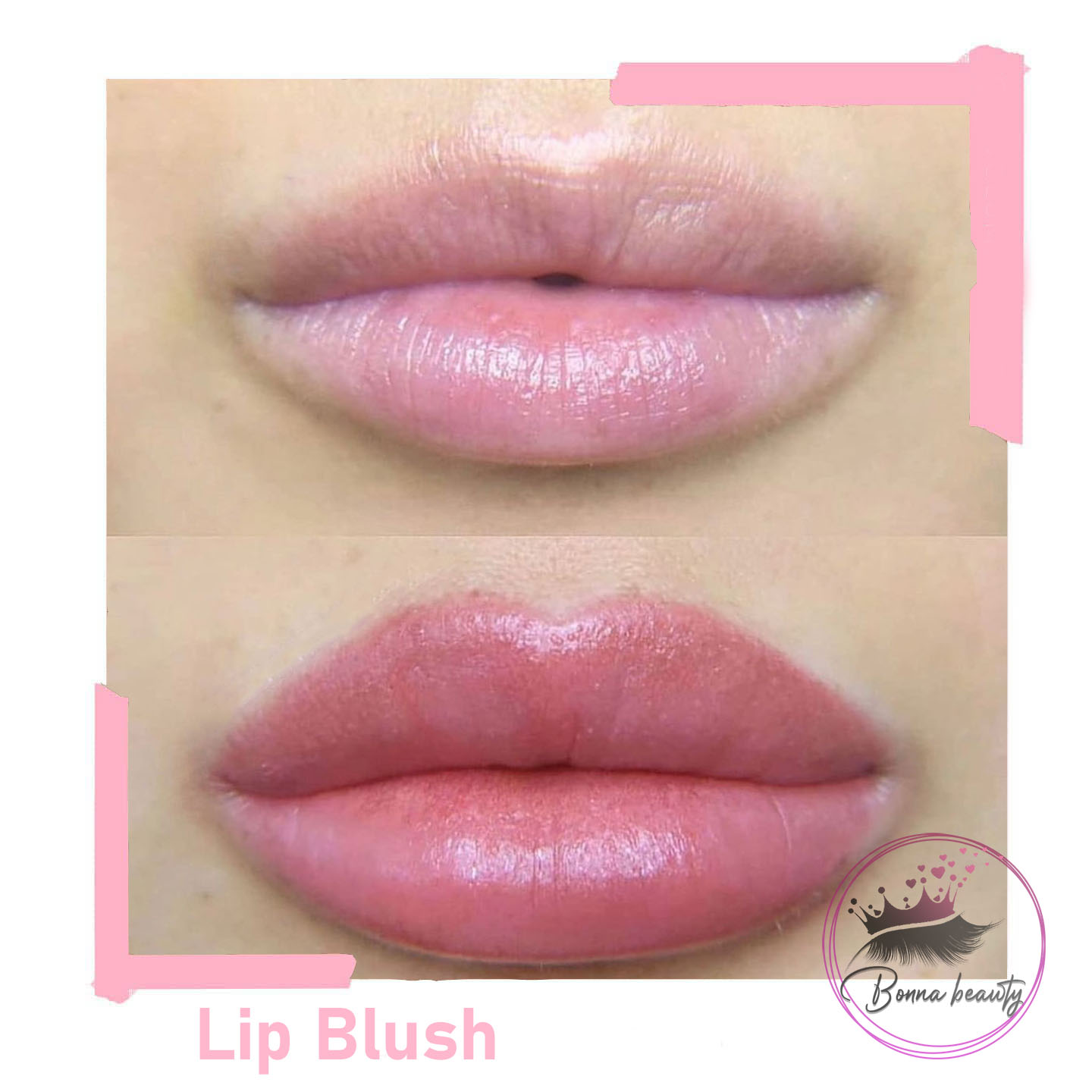 How to prepare for Lip Blush Tattooing before procedure? 1 How to prepare for Lip Blush Tattooing before procedure?